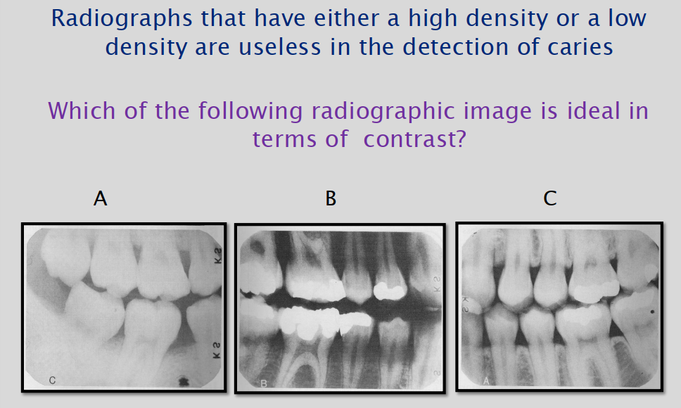 <p>T or F - High contrast films are recommended for bitewing films because optimal contrast enhances caries detection.</p>