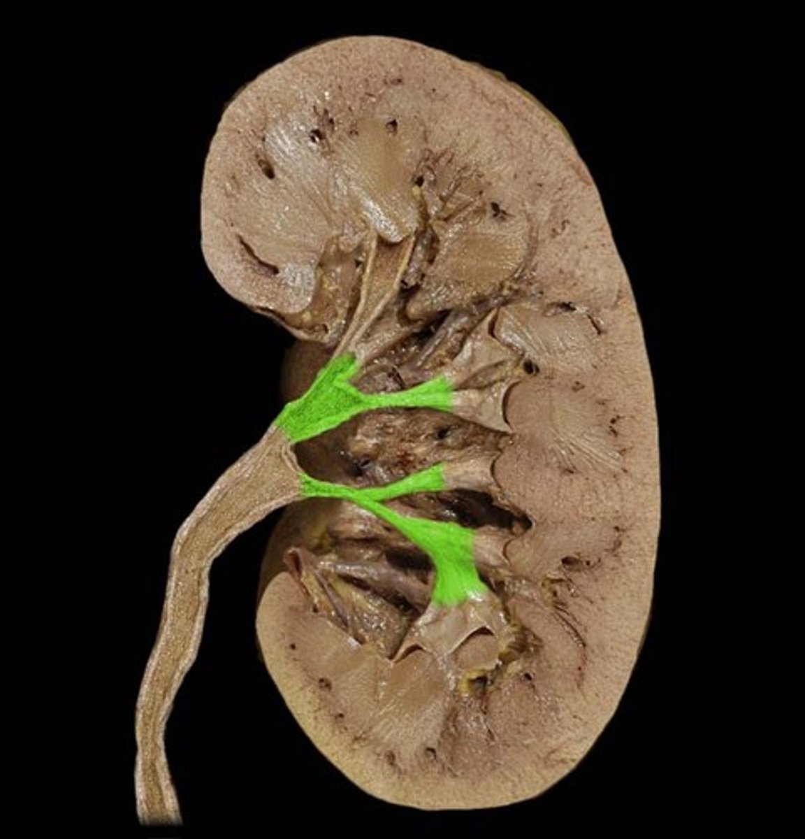 <p>Cup-like cavities that collect urine and empty into the renal pelvis</p>