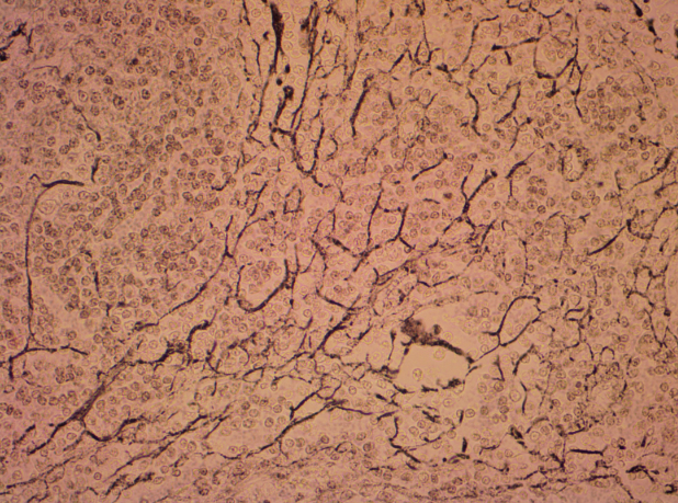 <p>A type of connective tissue that contains a network of reticular fibers and cells, providing a supportive framework for organs such as the liver, spleen, and lymph nodes. </p>