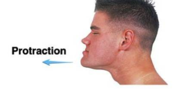 <p>moving in an anterior (forward) direction</p>
