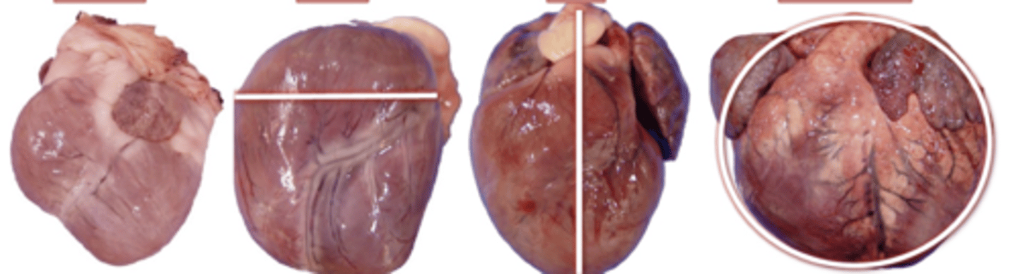 <p>What gross change is apparent due to right cardiac hypertrophy?</p>
