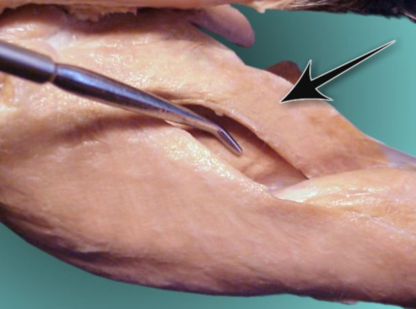 <p>Identify what the arrow is pointing to</p>