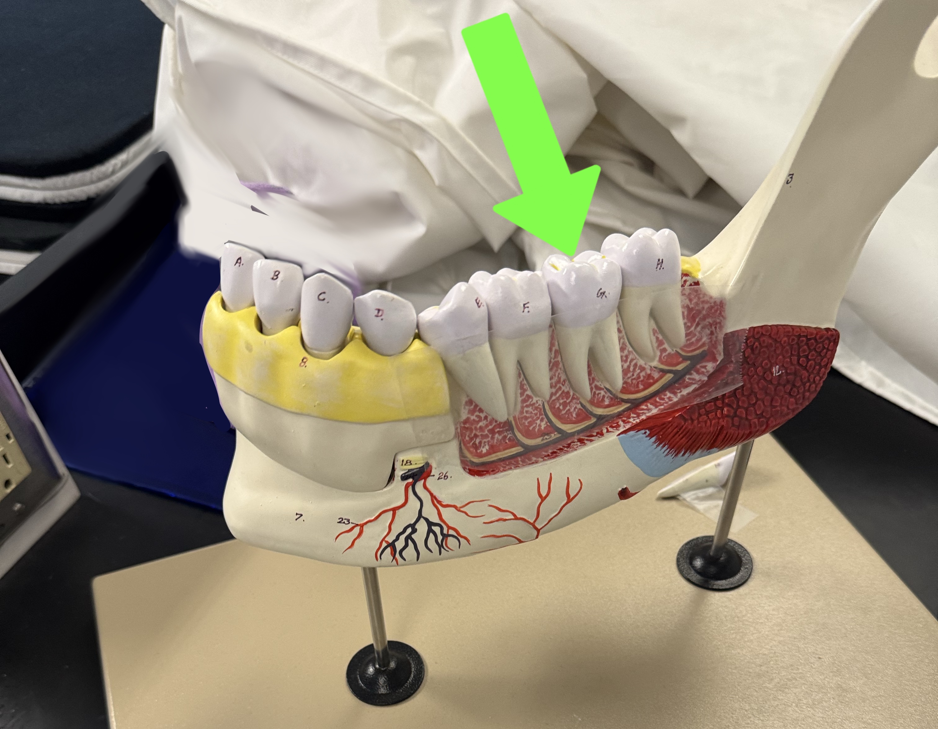 <p>what type of tooth is this</p>