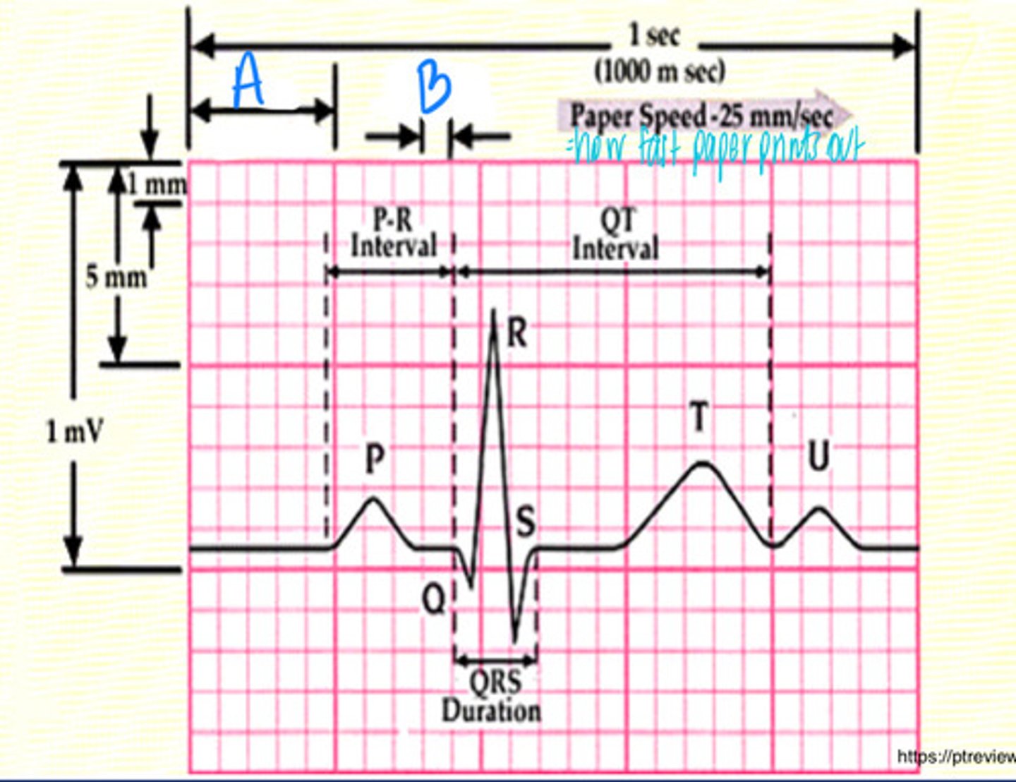 <p>What is B moving at the normal paper speed of 25 mm/s</p>