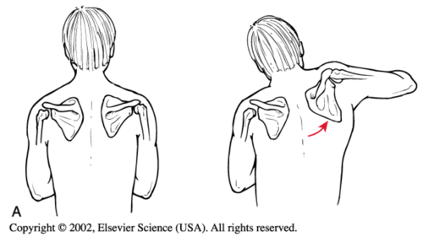 <p>-PROM or AAROM within SAFE and PAIN-FREE ranges based on surgeon</p><p>-Only PROM, non-assisted ROM for 6-8weeks after repair</p><p>-Minimize superior/anterior translation of humeral head</p><p>-do not allow active shoulder flex/ABD until patient can lift arm without hiking shoulder</p>