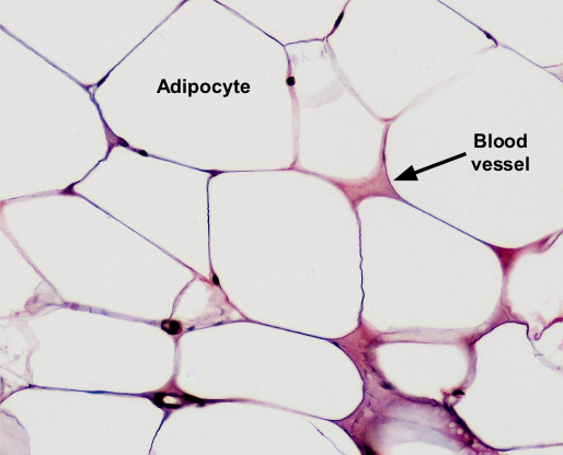 <p>bottom layer of the skin,&nbsp;abdomen, and heart </p>