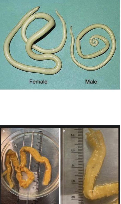 <p>A- Identify</p><p>B- what is the methods of diagnosis , or we see it in what specimen ?</p><p>C - in macroscopic examination we look at</p>