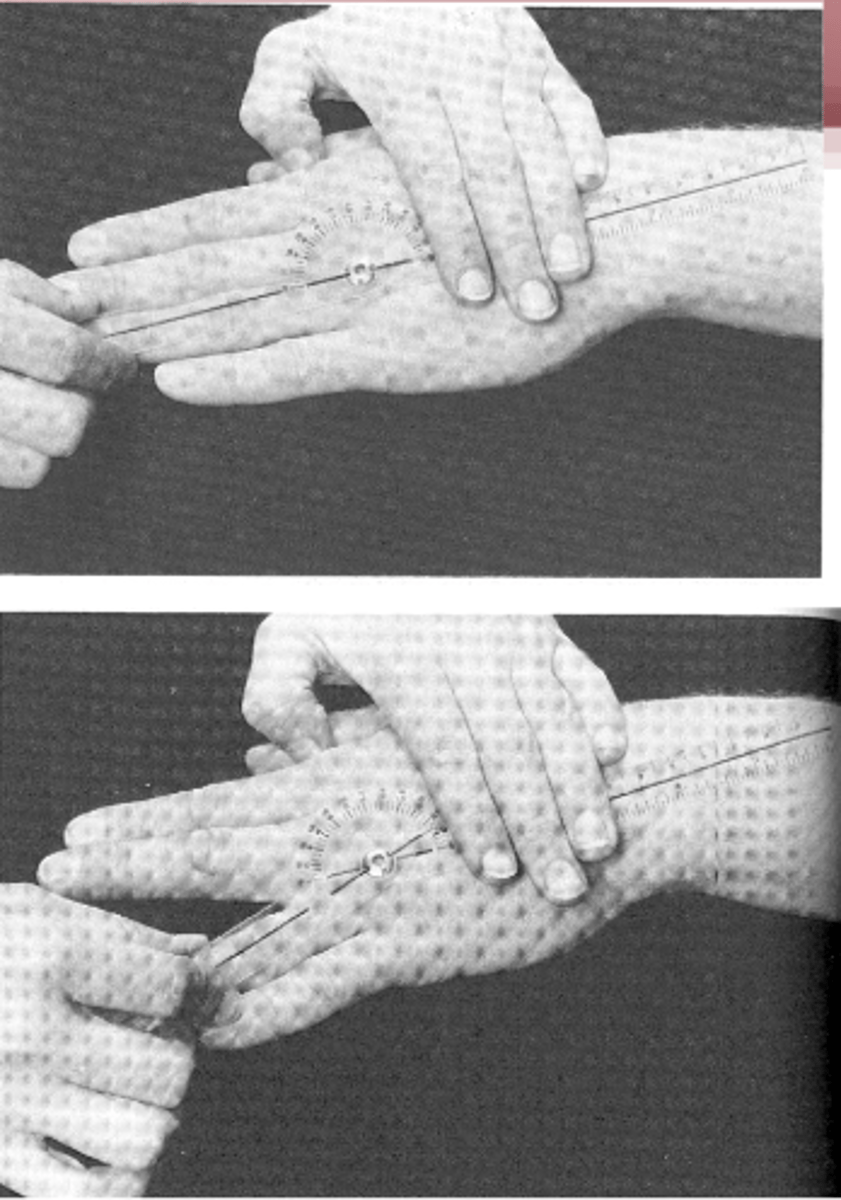 <p>metacarpus tengelyében</p>