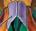 <p>Nasal bones</p>