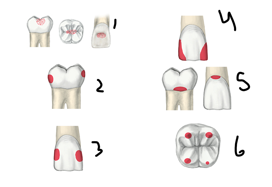 <p>Label type of tooth issue from 1-6</p>