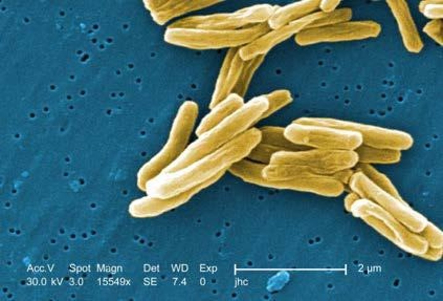 <p>It provides resistance to decolorization and prevents Gram staining.</p>