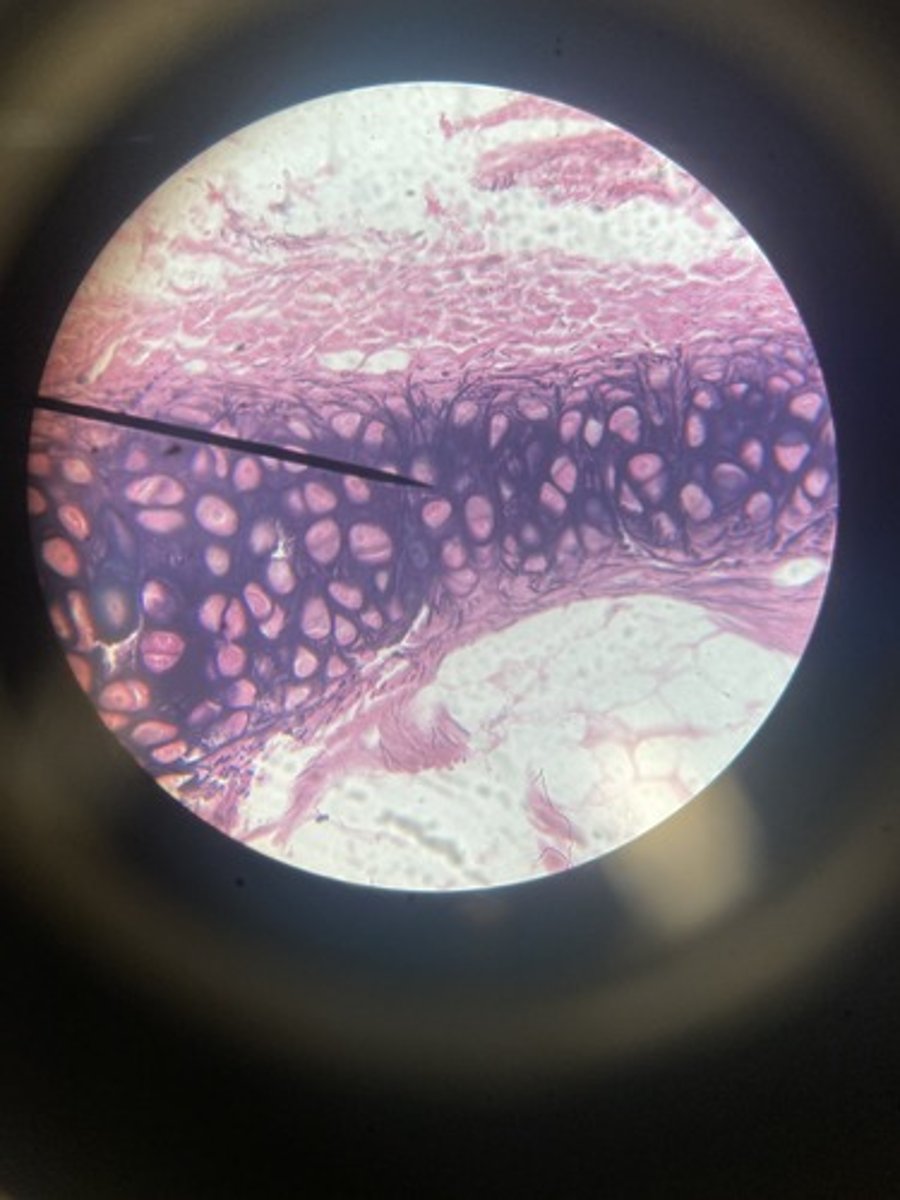 <p>What type of cartilage</p>