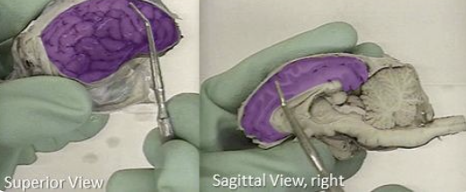 <p>one half of the cerebrum </p>