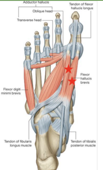 <p>Flexor hallucis brevis </p>