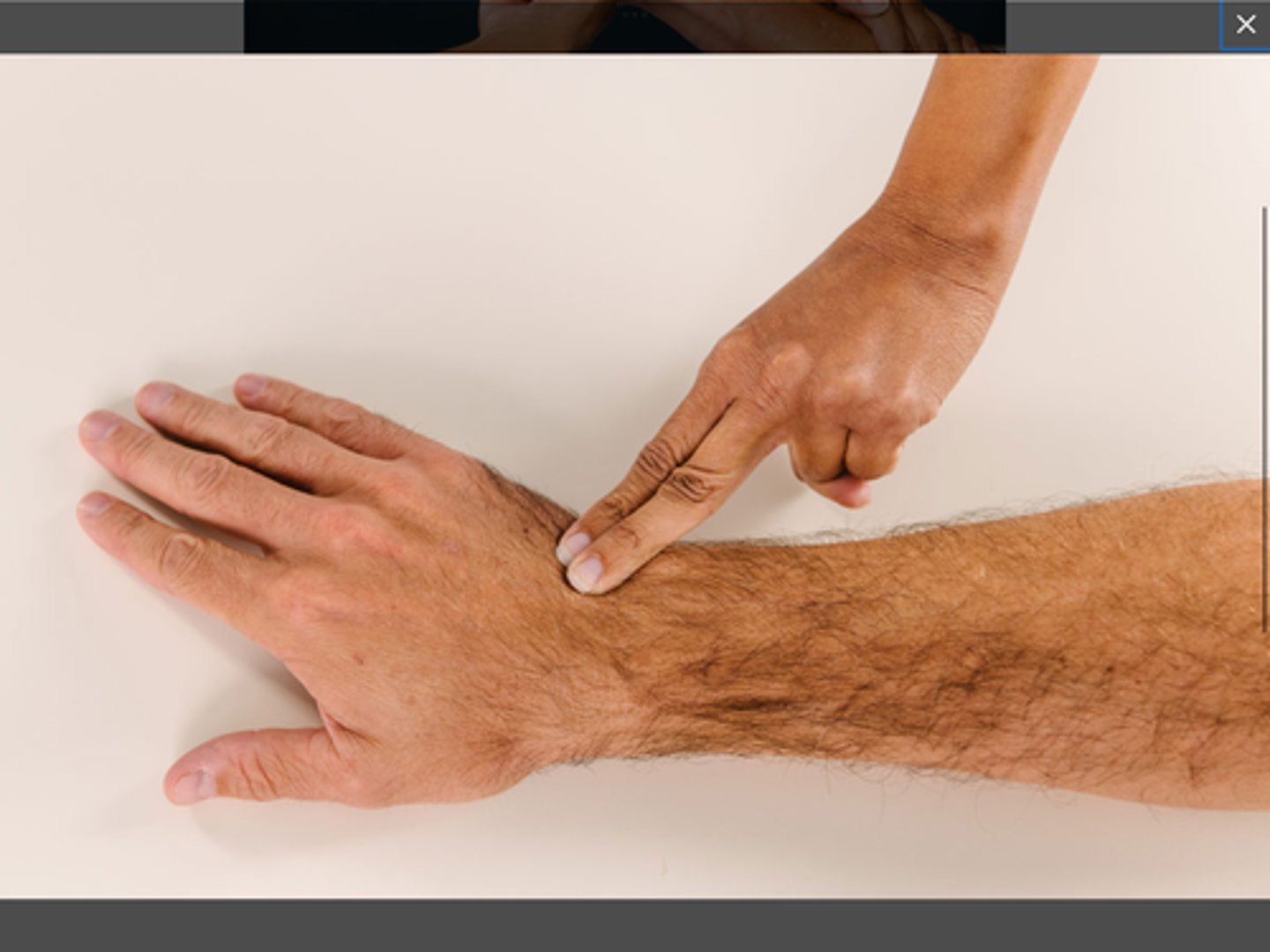 <p>Patient Position: Sitting with forearm pronated and hand resting on tabletop</p><p>Palpation: ECU at dorsal wrist and FCU at volar wrist</p><p>Compensations: Elbow extension and finger abduction</p>