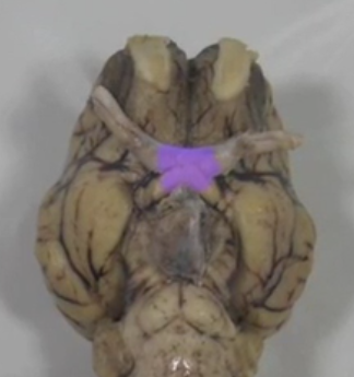 <p>Optic chiasm</p>