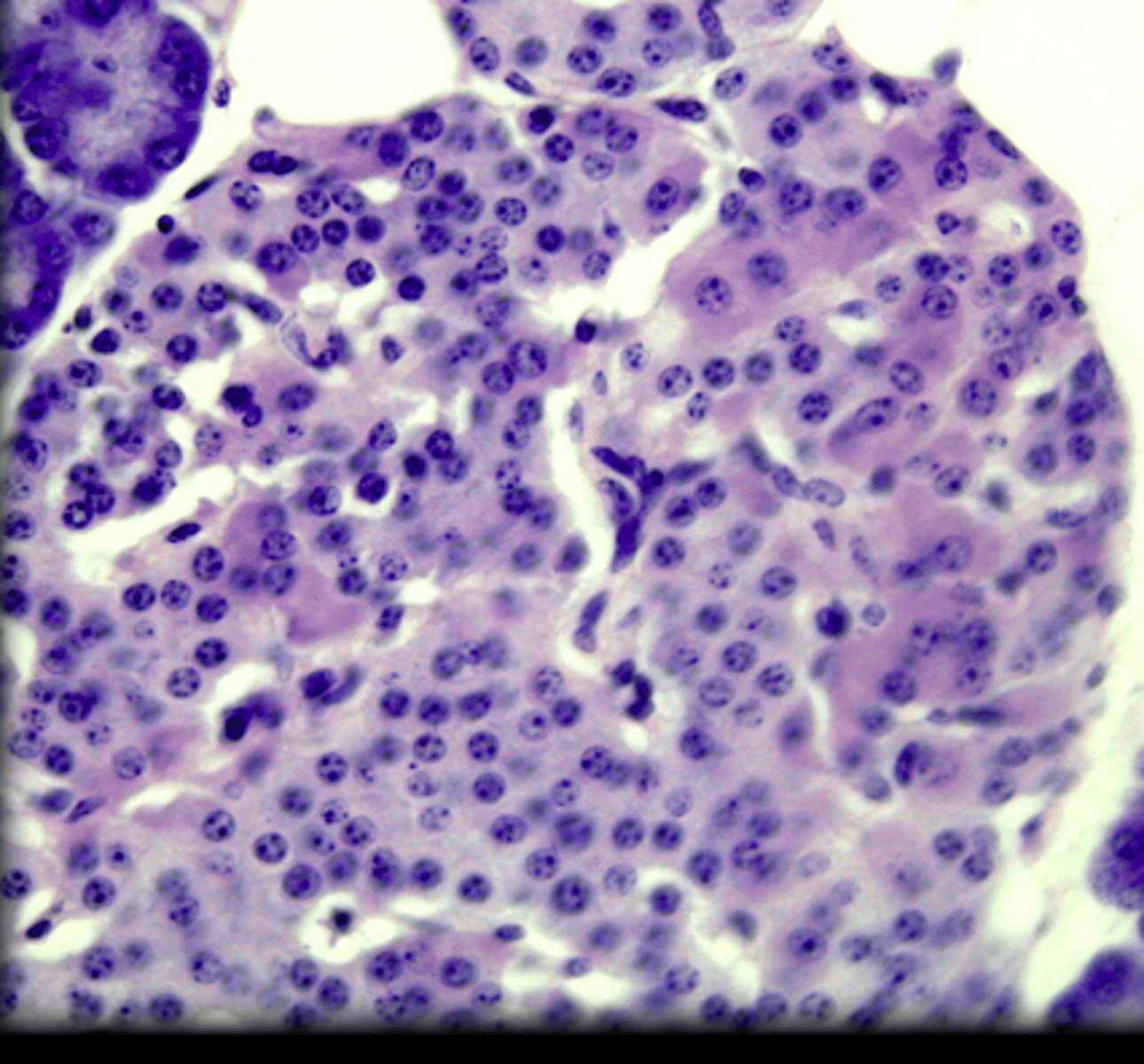 <p>darker stained cells</p>