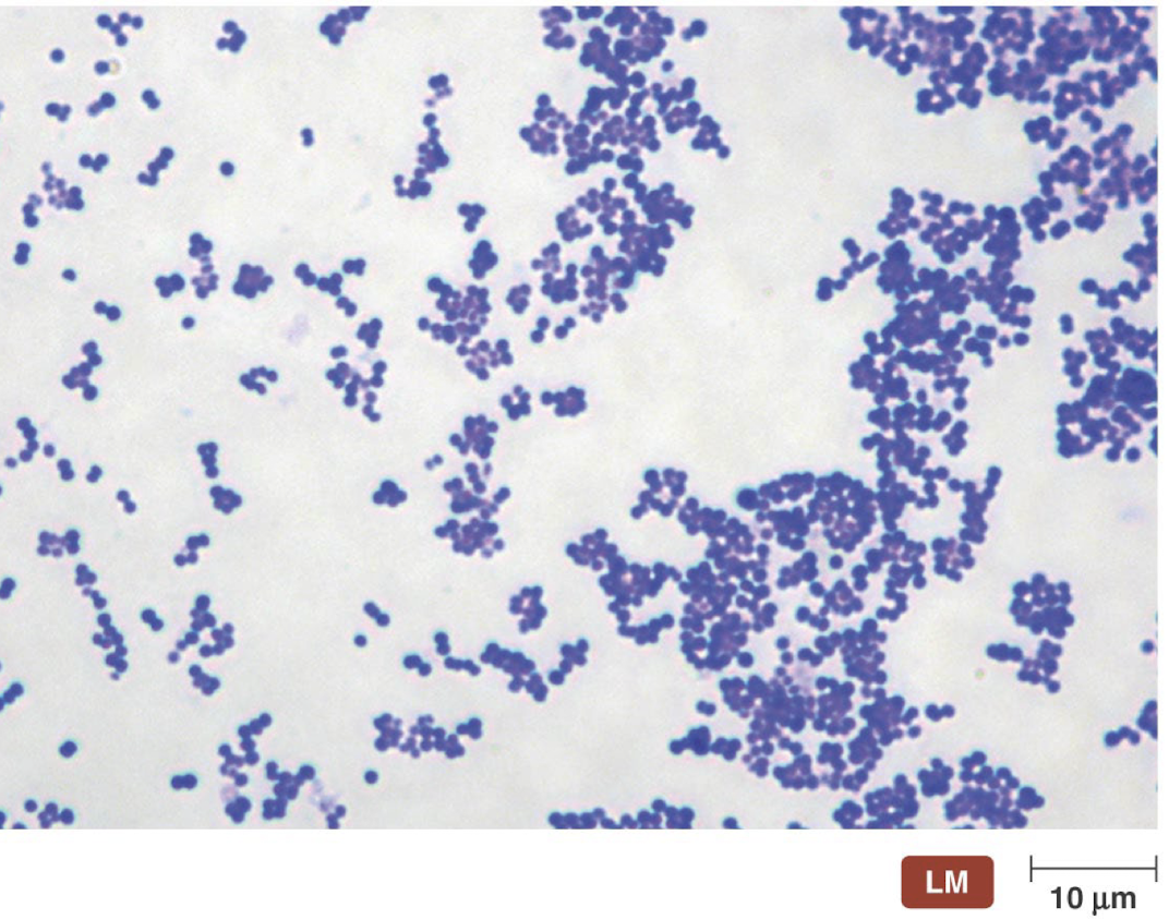 <ul><li><p>A.K.A. “Captain of the men of death”</p></li><li><p>Discovered by Louis Pasteur</p></li><li><p>5th leading cause of death in USA</p><ul><li><p>Follows influenza being the only infectious disease among the top 10</p></li></ul></li><li><p>150,000 ~ 270,000 cases of pneumococcal pneumonia and 2600 ~ 6200 cases of pneumococcal meningitis occur each year in the USA</p></li><li><p>Part of lungs, sinuses, and middle ear microbiota</p></li><li><p>Endogenous species</p></li><li><p>Carries asymptomatically in the upper respiratory tract by 5-70% of the general population</p><ul><li><p>Lowest carriage rates among adults living with NO children and highest among the population with adults and children in close proximity when the weather is cold</p></li></ul></li></ul><p></p>