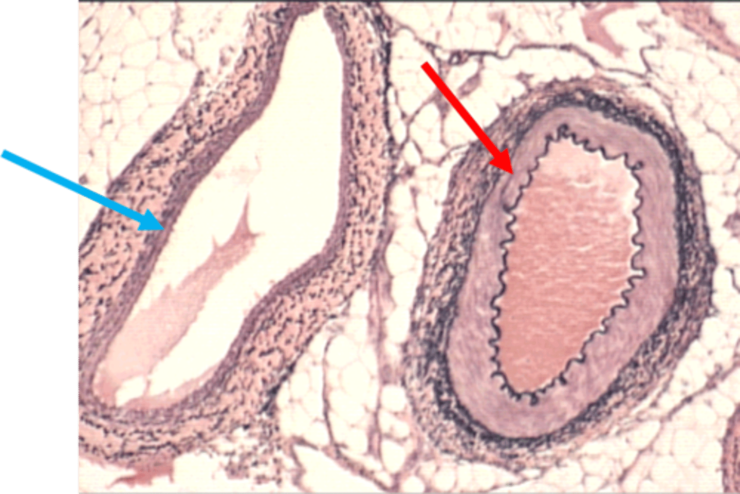 <p>blue arrow</p><p>medium size vein</p>