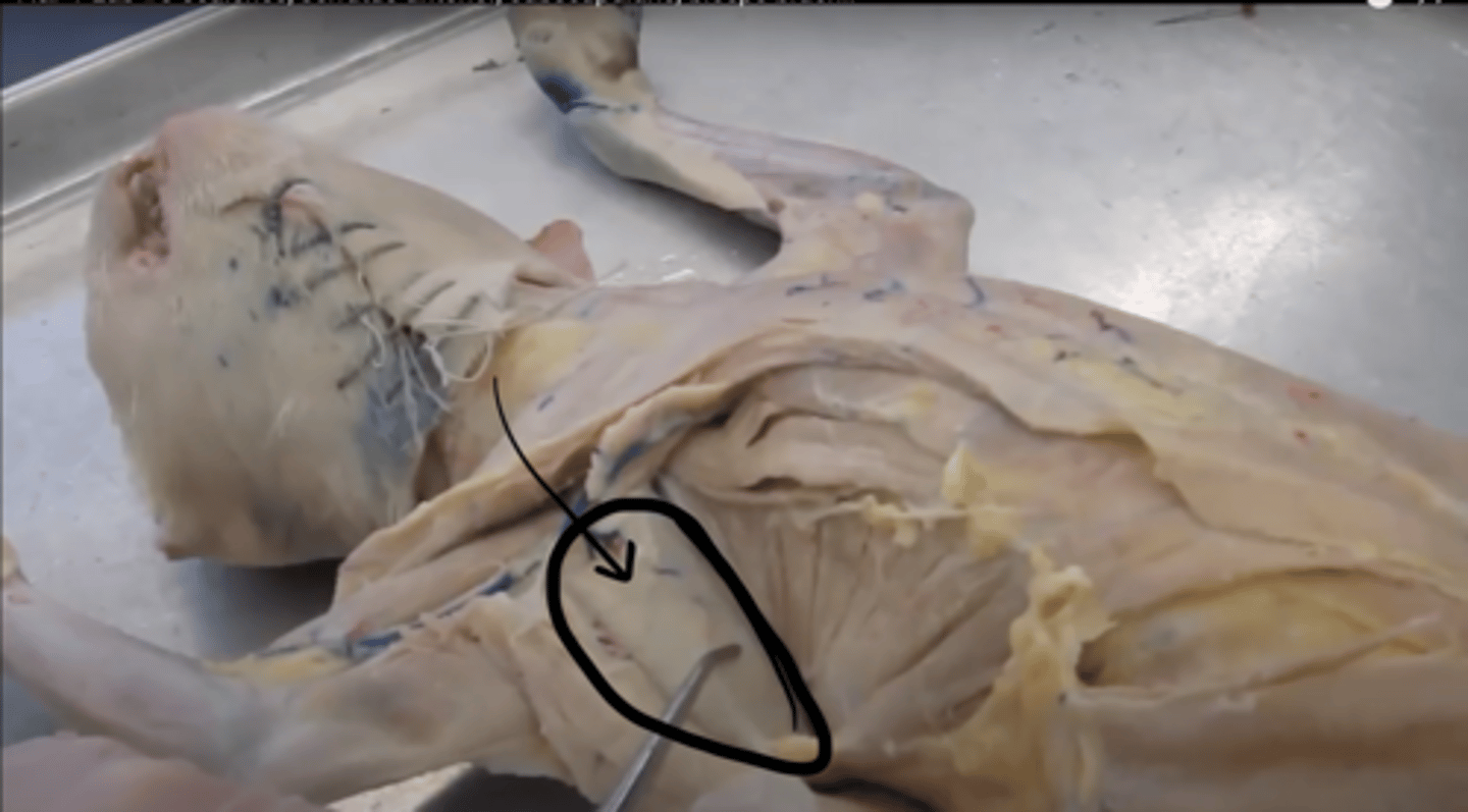 <p>name this muscle</p>