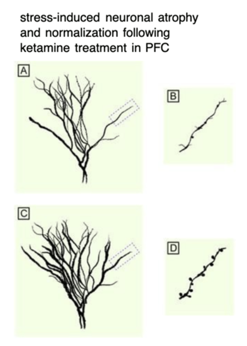<p>excess extracellular glutamate</p><p>- dendritic retraction, reduced dendritic arborization and spine density (A and B)</p><p>24 hours posttreatment (C and D):</p><p>- Sub-anesthetic dose of ketamine reverses the chronic stress-induced structural deﬁcits </p><p>- Rapid induction of BDNF</p><p>- increased synaptogenesis and spine density</p><p>- Similar effects to traditional antidepressants (ADMs) </p><p>- Neuroadaptive state occurs much faster with ketamine</p>
