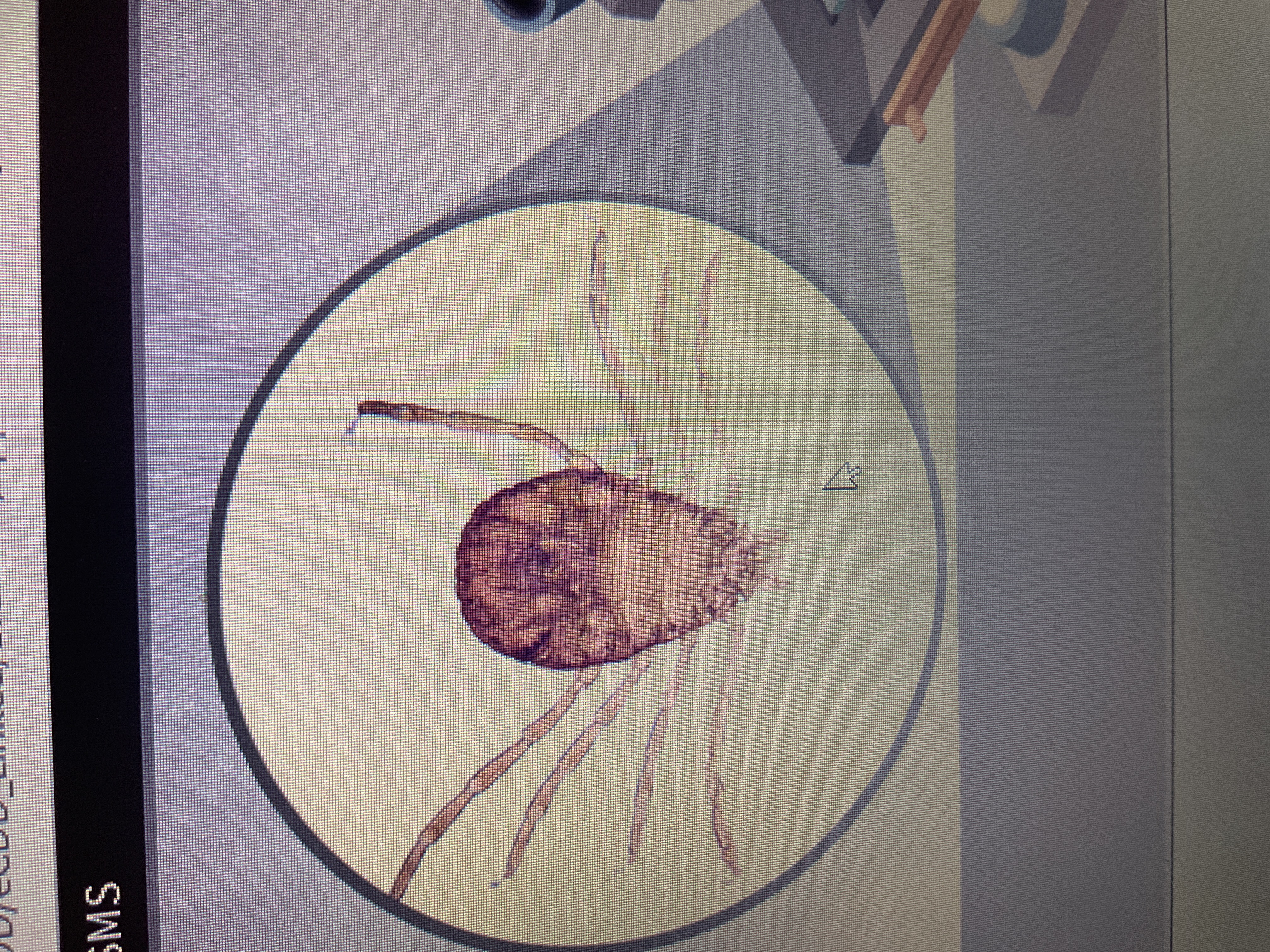 <p>Arthropod</p><p>tick</p><p>transmits various diseases</p>