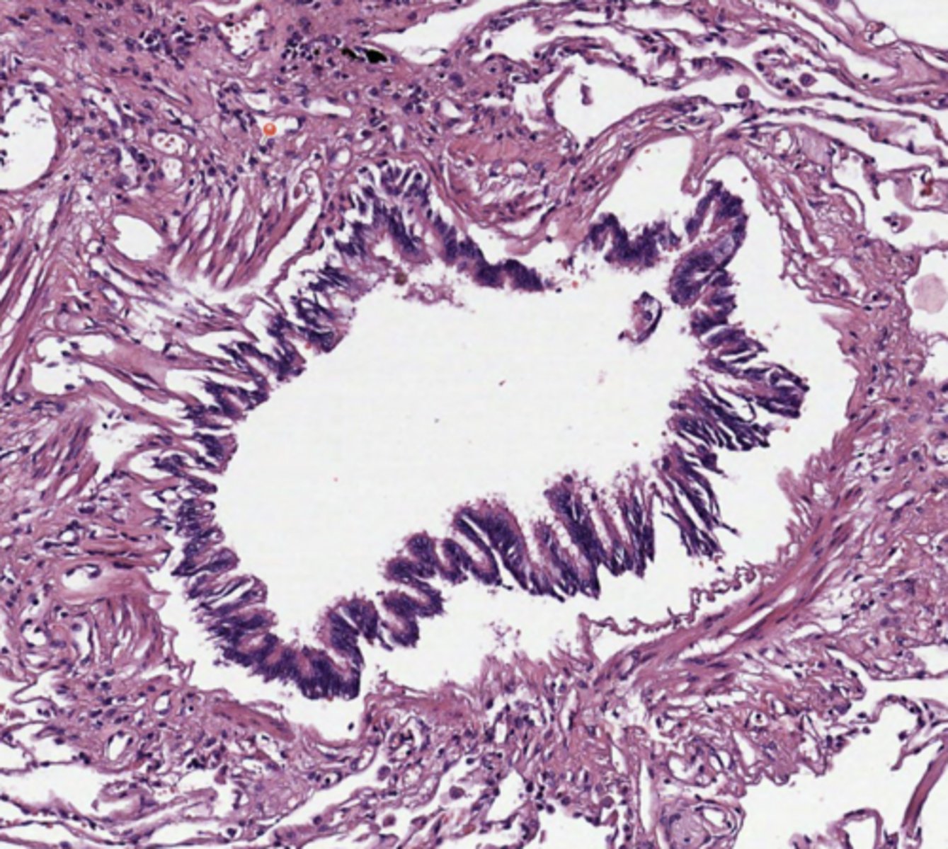 <p>Lung</p>