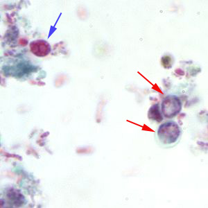 <p>in human and animal stool</p><p>abdominal pain, diarrhea, dehydration</p><p>worldwide</p>