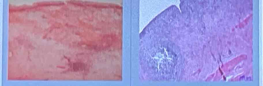 term image