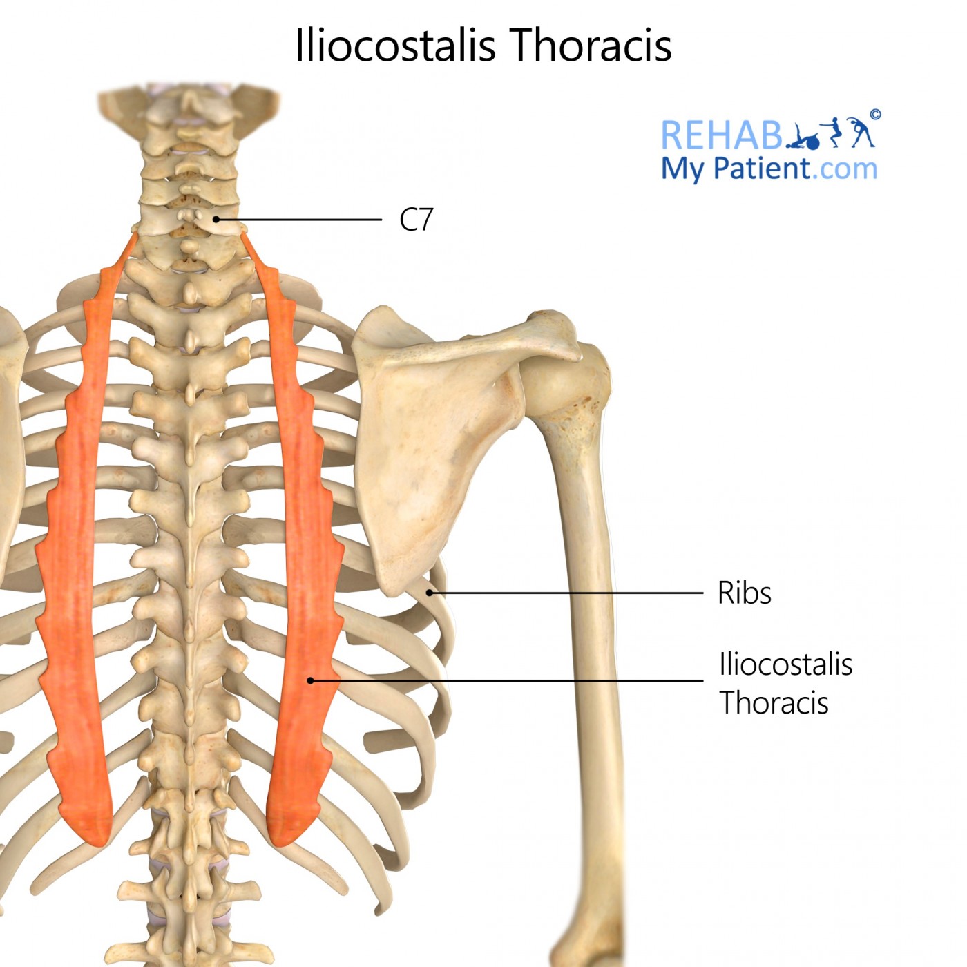 <p><strong>Proximal Attachment</strong></p><p><span>Angle of lower 6 ribs</span></p><p><strong>Distal Attachment</strong></p><p><span>Angles of upper 6 ribs, transverse process of C7</span></p><p><strong>Peripheral Innervation</strong></p><p>posterior rami of spinal nerves</p><p><strong>Action</strong></p><p>Back extension, lateral flexion</p>