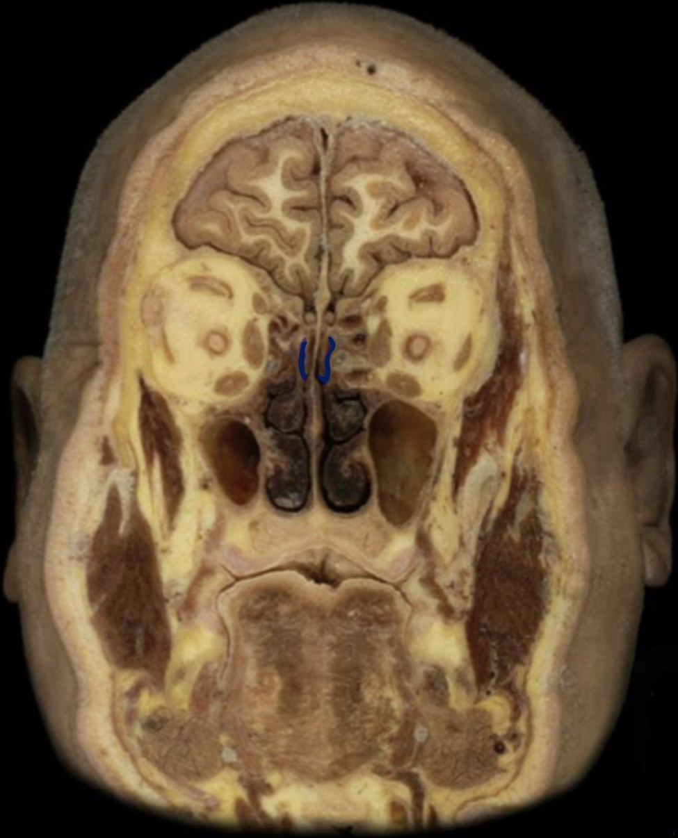 What structure is highlighted in blue?