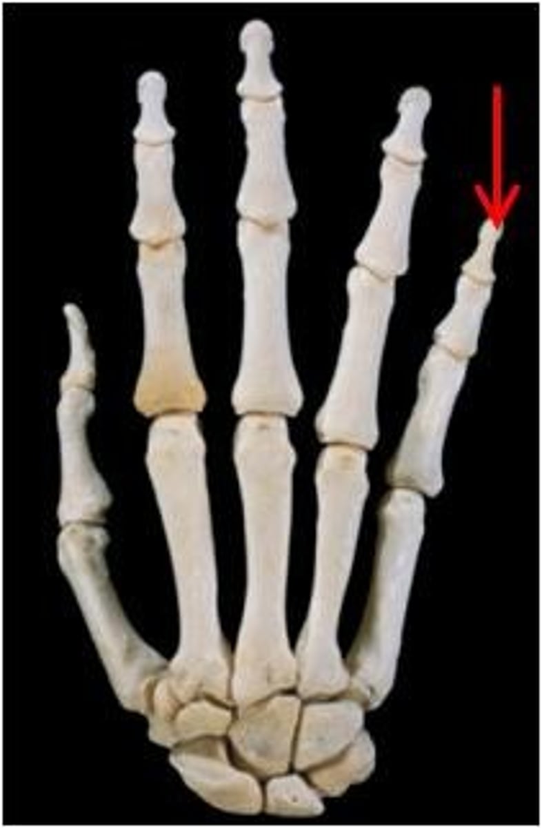 <p>ID bone</p>