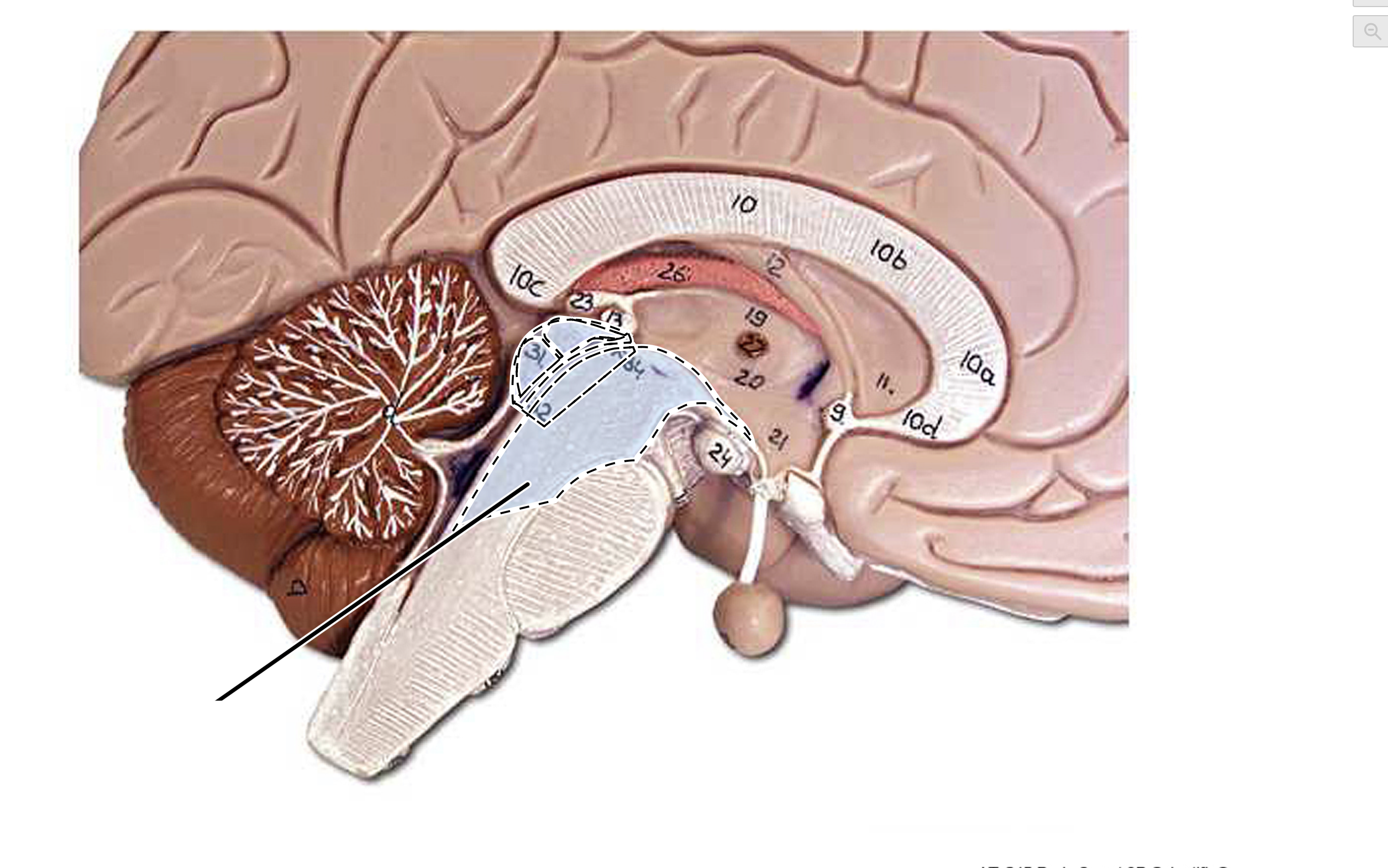term image
