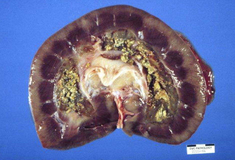<p>What is medullary necrosis and what predisposes the medulla to injury?</p>