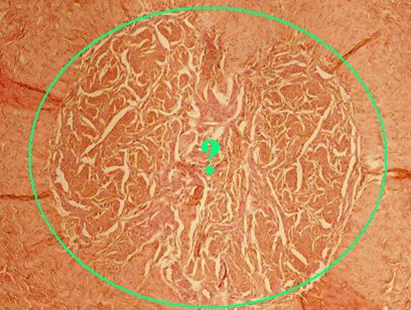 <p>What is the indicated erectile tissue of the penis called?</p>