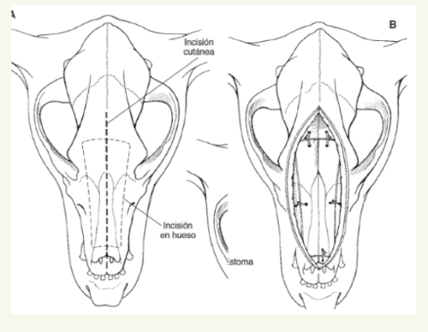 <p>rinostomía dorsal</p>