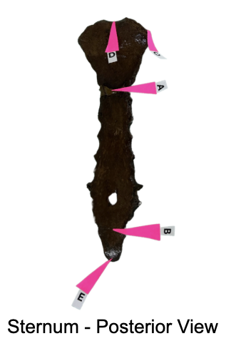 <p>Identify the vertebral level of the landmarks of the sternum: <span>This usually lands at the level of C7-T1.</span></p><p>A. The “Angle of Louis”.</p><p>B. The “Xiphisternal Joint”</p><p>C. The Groove for “Sternal End of the Clavicle”</p><p>D. The “Suprajugular Notch”</p><p>E. The “Tip of the Xiphoid Process”</p>