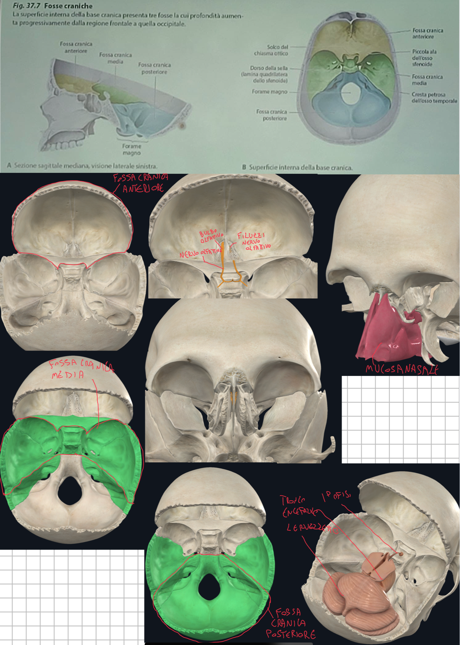 <p>Fossa Cranica Anteriore:</p><ul><li><p>Comprende l’osso Frontale, la lamina cibrosa dell’Etmoide e le piccole ali dello Sfenoide</p></li><li><p>Contiene i lobi frontali dell’encefalo</p></li><li><p>Il suo pavimento rappresenta il tetto delle cavità nasali</p></li><li><p>La lamina cibrosa dell’Etmoide è caratterizzata da numerosi fori per il passaggio dei filuzzi del nervo olfattivo che originano dalla mucosa nasale verso il bulbo olfattivo. Unico caso in cui i neuroni si prolungano all’ambiente esterno per funzioni recettoriali (odori)</p></li></ul><p>Fossa Cranica Media:</p><ul><li><p>Comprende corpo e grandi ali dello Sfenoide, e porzione anteriore della parte petrosa del Temporale</p></li><li><p>Contiene i lobi temporali, ipofisi e i lobi mediali degli emisferi cerebrali</p></li></ul><p>Fossa Cranica Posteriore:</p><ul><li><p>Comprende l’osso Occipitale e porzione posteriore della parte petrosa del temporale e Clivo dello Sfenoide</p></li><li><p>Contiene il cervelletto (separato dai lobi occipitali dal tentorio) e decorre tronco encefalico</p></li></ul><p></p><p>N.B.</p><p>Le fosse non sono tutte lungo lo stesso piano:</p><ul><li><p>La anteriore è la più alta, segue la media e la posteriore</p></li></ul><p></p>