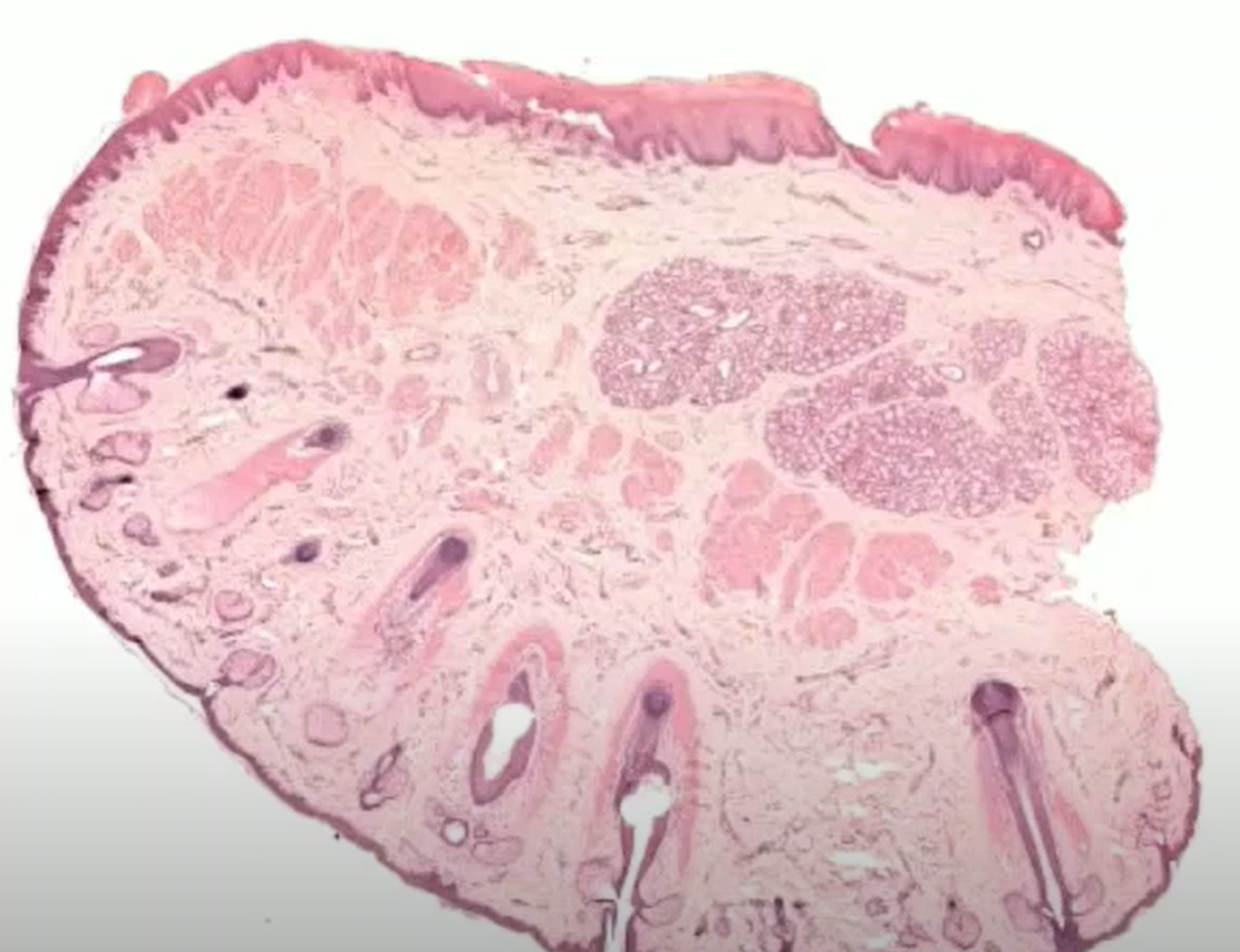 <p>Organ?</p>