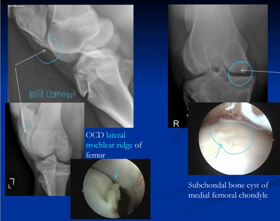 <p><span style="background-color: transparent;"><strong><span>Osteochondrosis</span></strong></span></p>