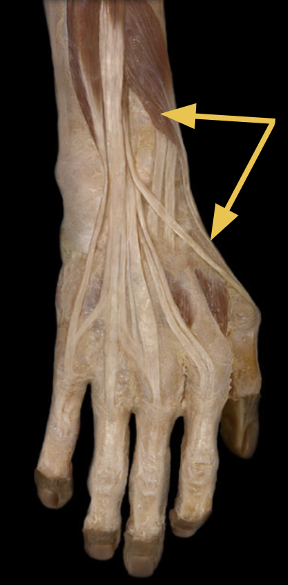 <p>extensor pollicis brevis m.</p><p>O: <span>shaft of radius and interosseous membrane</span><br>I: Base of proximal phalanx of thumb (digit 1)<br>A: Extend thumb at the MCP and IP joints<br>Inn: radial n. <br>-runs with the abductor pollicis longus through the first tunnel deep to the extensor retinaculum</p>