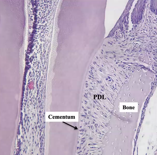 <p>what kind of cementum would be in the area indicated</p>