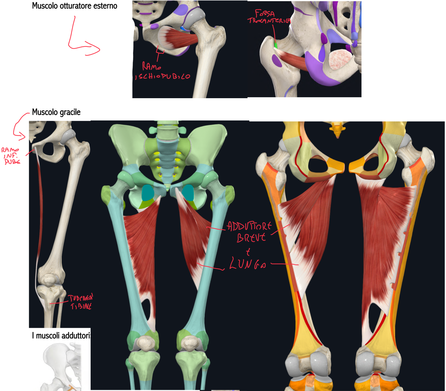 <p>Muscolo Otturatore Esterno:</p><ul><li><p>Origine → superficie esterna membrana otturatoria e margine osseo adiacente (ramo ischiopubico)</p></li><li><p>Inserzione → fossa trocanterica (superficie mediale grande trocantere)</p></li><li><p>Funzione → rotazione laterale della coscia (e adduzione)</p></li></ul><p>Muscolo Gracile:</p><ul><li><p>Origine → ramo inferiore pube (vicino la sinfisi pubica)</p></li><li><p>Inserzione → medialmente alla tuberosità tibiale</p></li><li><p>Funzione:</p><ul><li><p>Adduzione anca</p></li><li><p>Flessione e rotazione interna gamba a livello del ginocchio</p></li></ul></li><li><p>Clinica → il suo tendine è molto lungo e può essere prelevato per la ricostruzione di legamenti crociati</p></li></ul><p>Muscoli Adduttori breve e lungo:</p><ul><li><p>Origine Adduttore Breve → corpo e ramo inferiore pube</p></li><li><p>Inserzione Adduttore Breve → labbro mediale linea aspra (terzo prossimale)</p></li><li><p>Origine Adduttore Lungo → cresta pubica</p></li><li><p>Inserzione Adduttore Lungo → labbro mediale linea aspra (terzo medio)</p></li><li><p>Funzione → Adduzione coscia (anche flessione coscia)</p></li></ul><p></p>