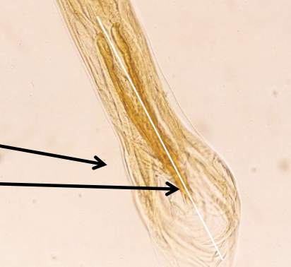 <p><span><span>Which parasites are shown in this picture, and which morphological feature supports this conclusion?</span></span></p>