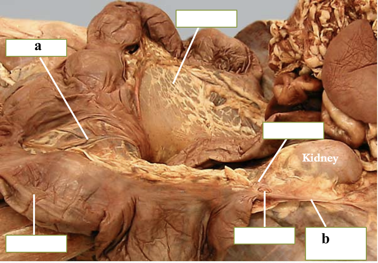 <p>b</p>