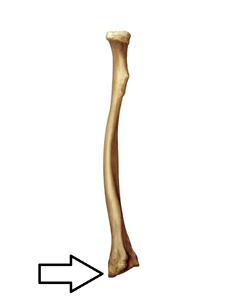 <p>what part of the radius is this?</p>