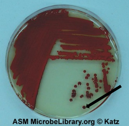 Describe the pigment of this colony