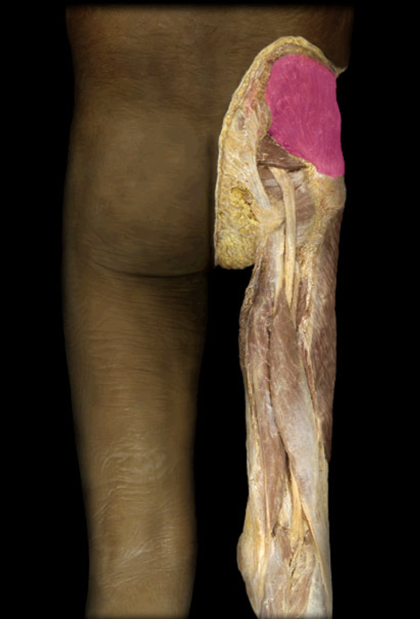 <p>Gluteus medius m. (innervation)</p>