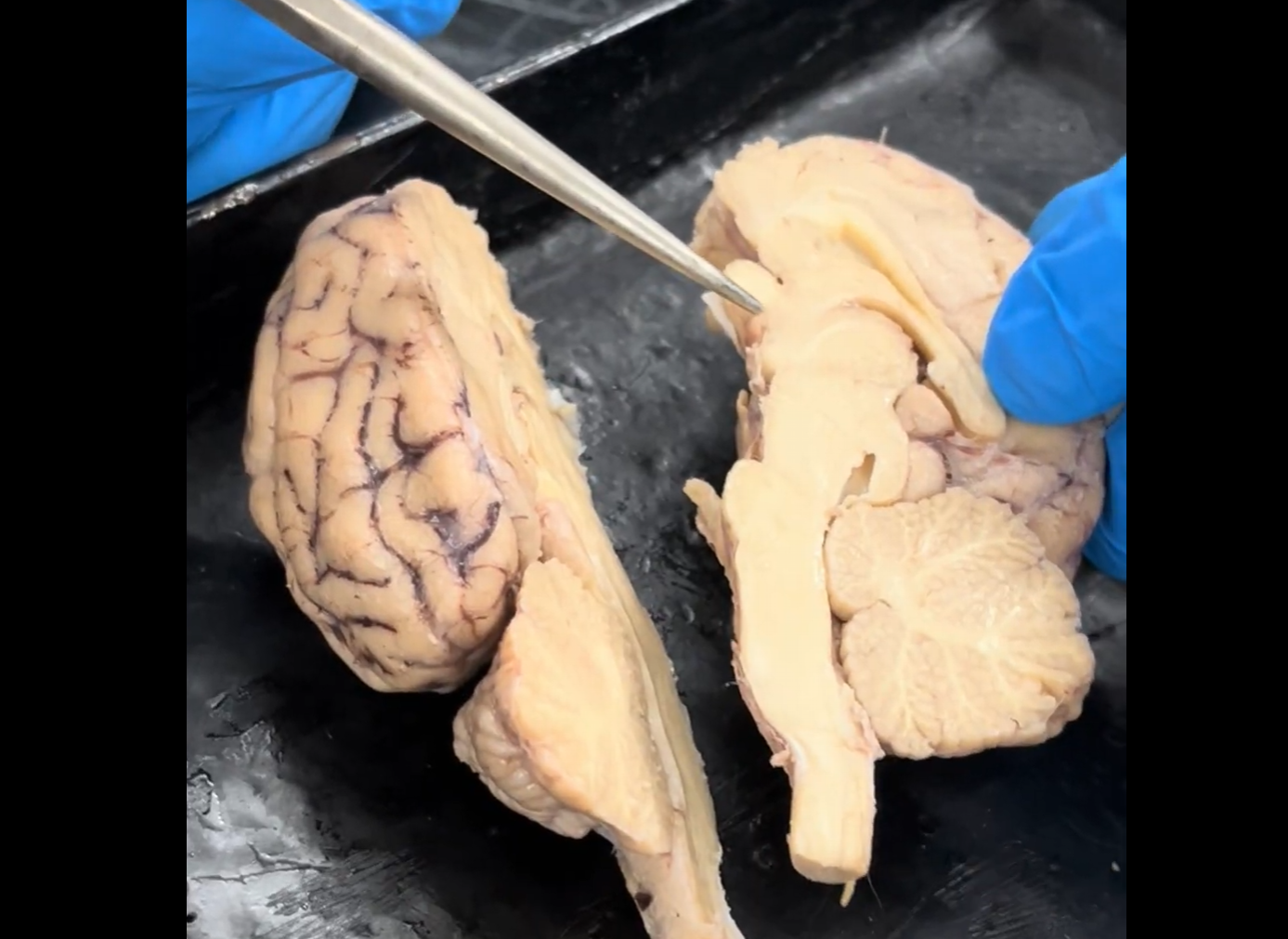 <p>What are the “gray” or darker parts of the brain called (seen most clearly in the cerebellum, in contrast to the arbor vitae.</p>