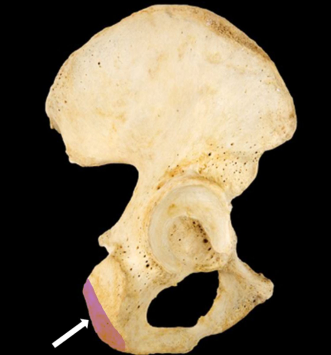 <p>name the part</p>